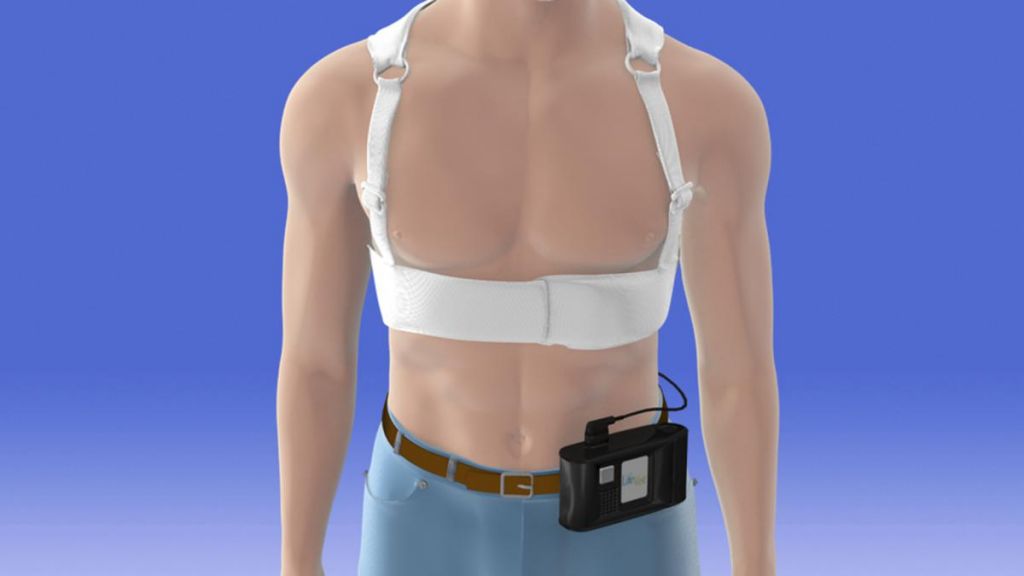  Il defibrillatore? Ora si puÃ² anche indossare.  La nuova tecnologia in uso alla  Montevergine spa