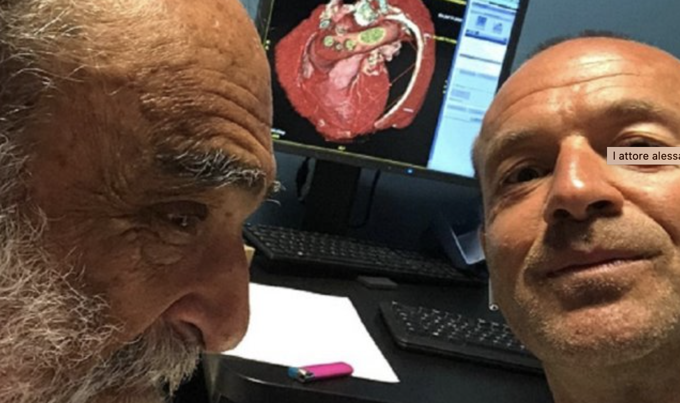  L’attore Alessandro Haber in cura alla clinica Montevergine