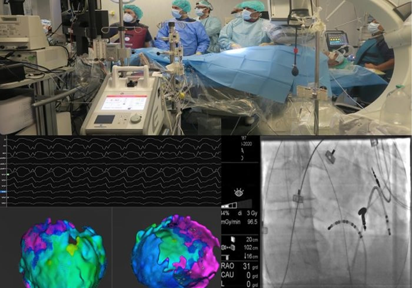  Tecnica innovativa salvavita alla clinica Montevergine